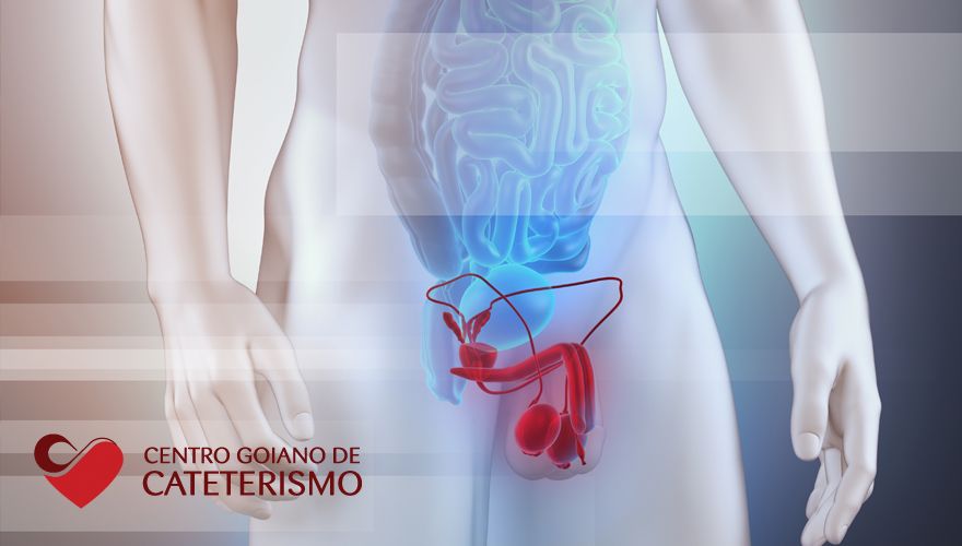 Hiperplasia de Próstata